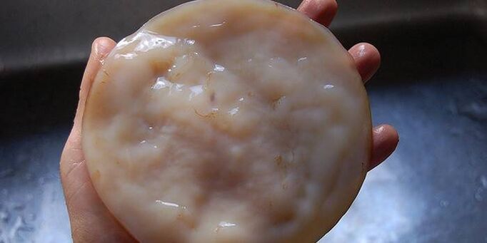 Kombucha protiv gljivica na noktima